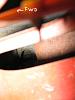 Why do sa's rust here?-img_0037.jpg