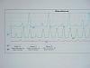 Ebay 20b Engines-20b-compression-graph-1.jpg