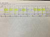 My Attempt at a simplified sequential FD-fsm-wiring-diagram-turbo-solenoids.jpg