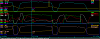 injector staging still something wrong-graphlean.png