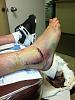 Ongoing New Mexico thread-ankle2.jpg