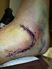 Ongoing New Mexico thread-ankle.jpg