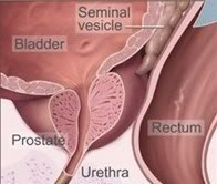 Name: prostate.jpg
Views: 53
Size: 9.1 KB