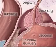 Name:  invertedprostate.jpg
Views: 36
Size:  9.2 KB