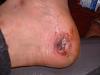 Reasons not to horseplay in a shop-my-foot.jpg
